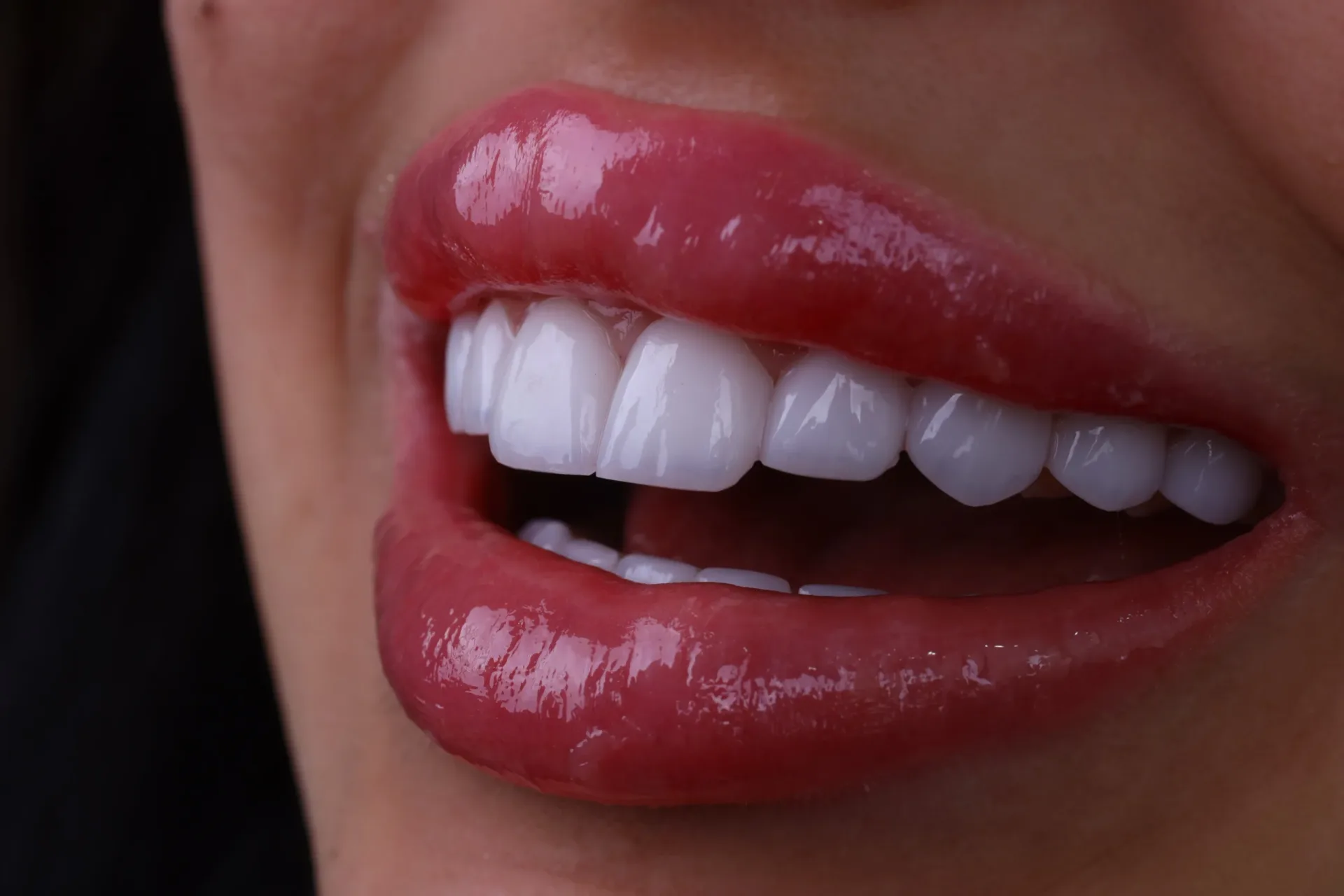 Фоновое изображение Alanya Dental Place